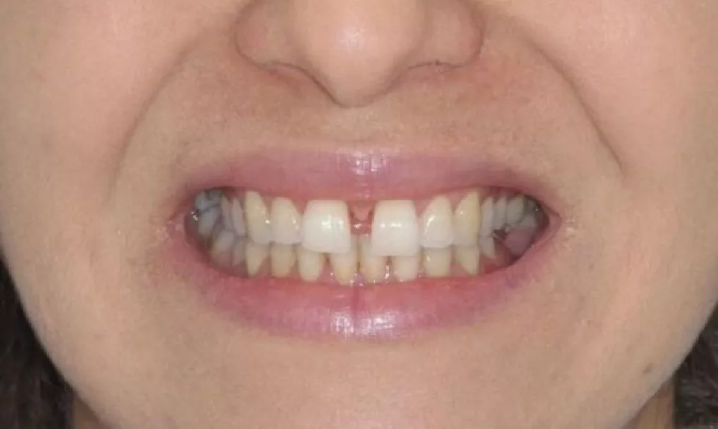 Orthodontiste à Casablanca, Centre d'orthodontie Abdelmoumen