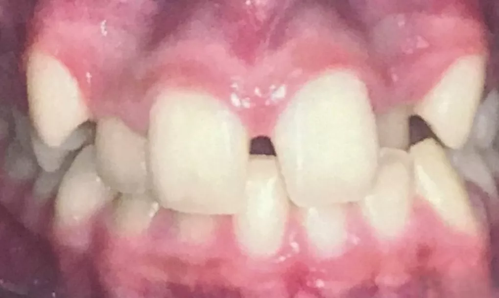 before-after