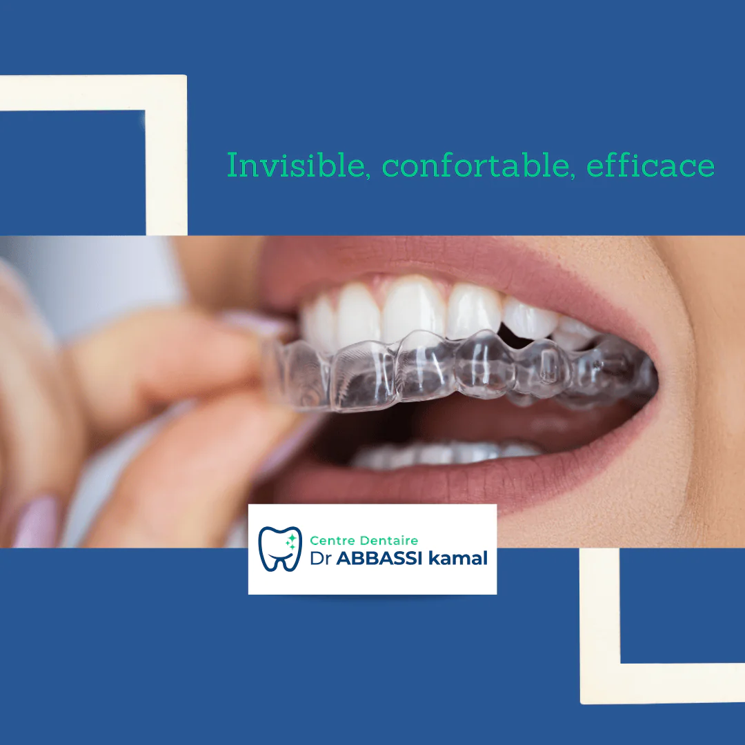 Dr Abbassi Dentist Invisalign Casablanca V2